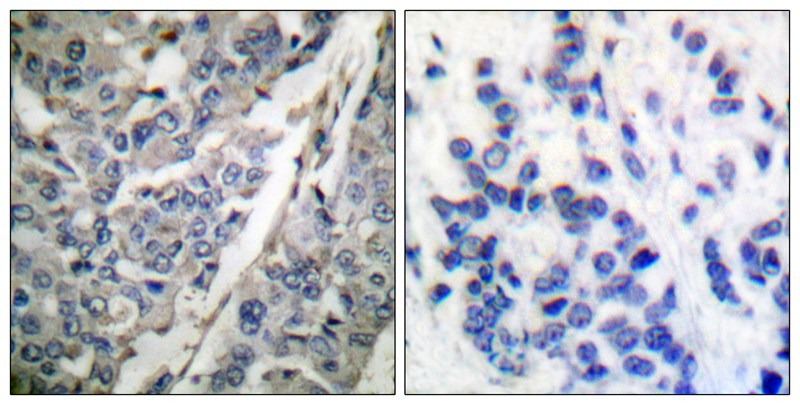 Anti-Phospho-Synaptotagmin-1 (Thr202) Polyclonal Antibody