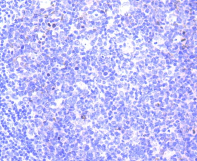 Anti-Survivin Antibody (3J595)