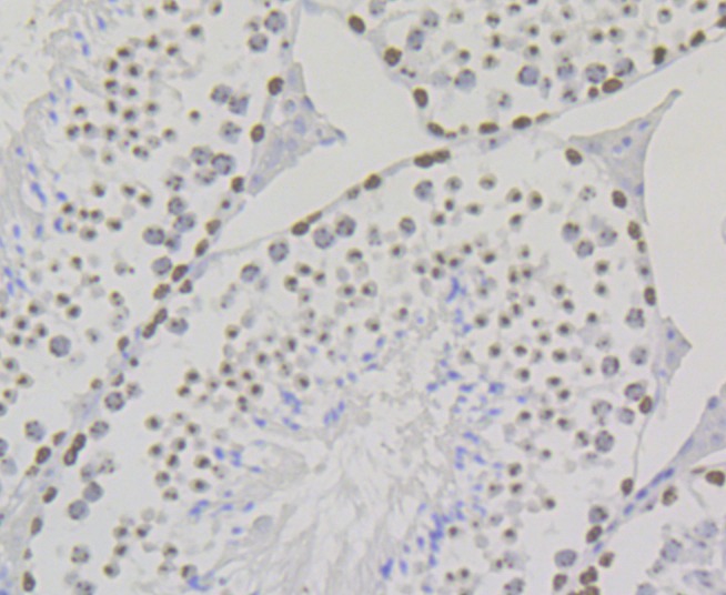 Anti-SUV39H2 Antibody (8R663)