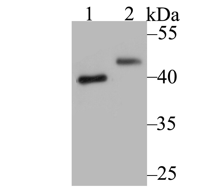 Anti-SUV39H2 Antibody (8R663)
