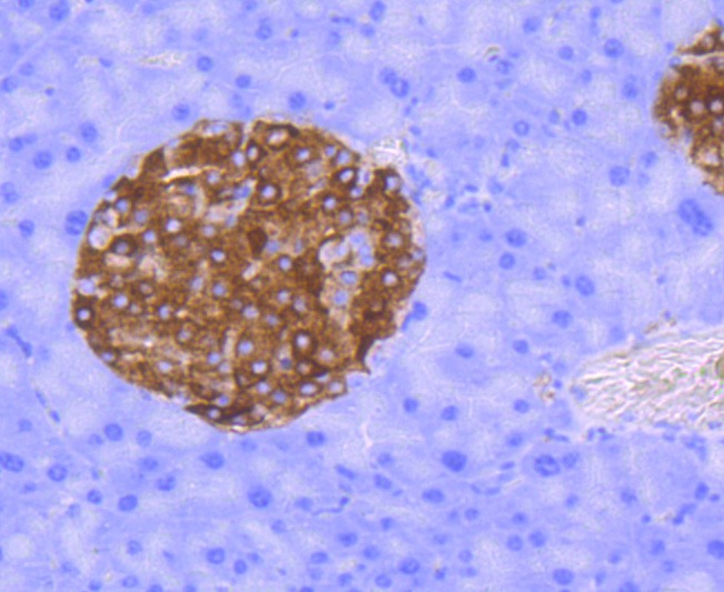 Anti-Synaptophysin/SYP Antibody (1U942)