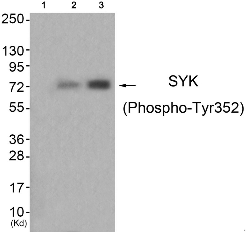 Anti-Phospho-Syk (Tyr352) Polyclonal Antibody