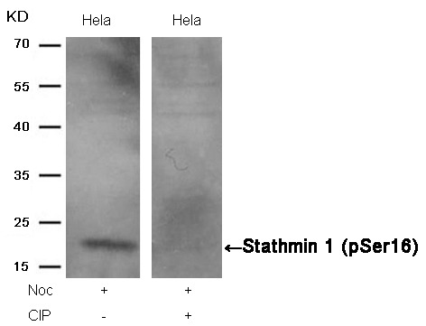 Anti-Phospho-Stathmin 1 (Ser16) Polyclonal Antibody