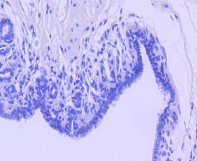 Anti-Survivin Antibody (3J595)
