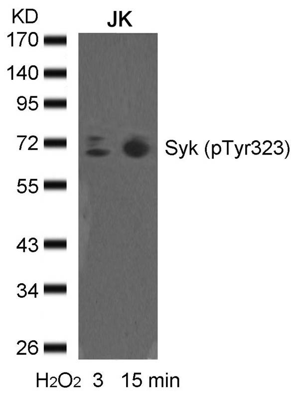 Anti-Phospho-Syk (Tyr323) Polyclonal Antibody