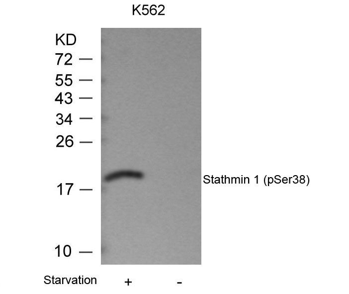 Anti-Phospho-Stathmin 1 (Ser38) Polyclonal Antibody