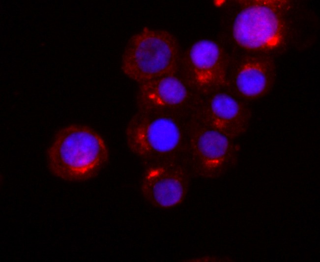 Anti-Synaptophysin/SYP Antibody (1U942)