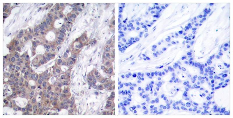 Anti-Phospho-Stathmin 1 (Ser16) Polyclonal Antibody