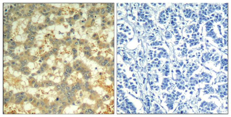 Anti-Phospho-Syk (Tyr323) Polyclonal Antibody