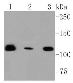 Anti-RNF20 Antibody (1Z606)