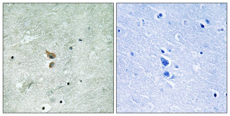 Anti-Phospho-RIPK2 (Ser176) Polyclonal Antibody