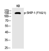 Anti-Phospho-INPP5D (Tyr1021) Polyclonal Antibody