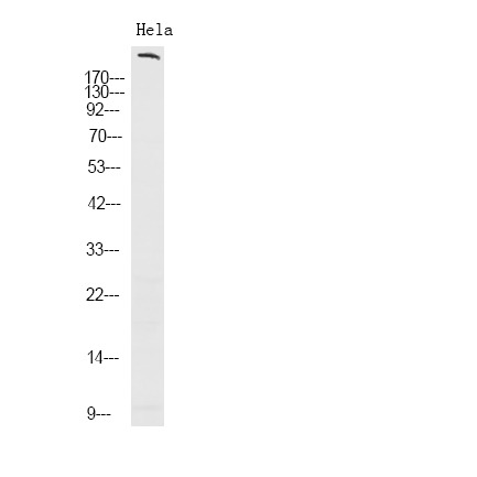 Anti-Phospho-ROS1 (Tyr2274) Polyclonal Antibody 2