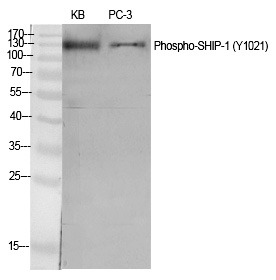 Anti-Phospho-INPP5D (Tyr1021) Polyclonal Antibody