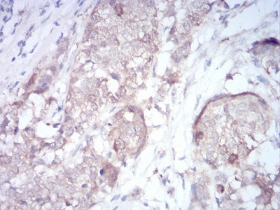 Anti-RND3 Antibody (2F966)
