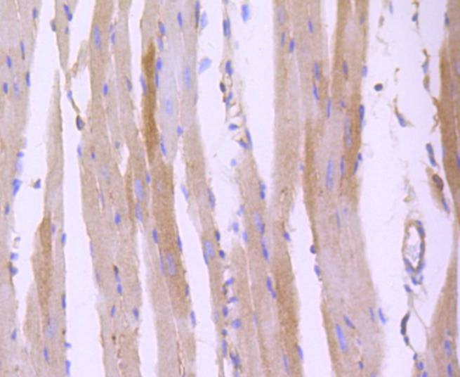 Anti-ROCK1 Antibody (4X563)