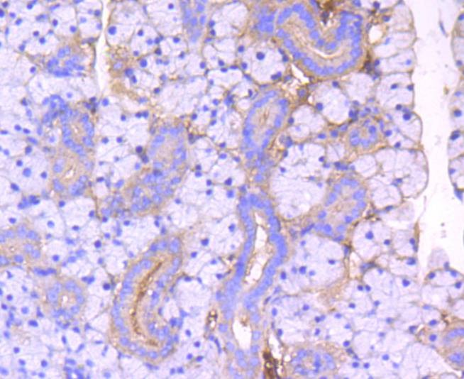 Anti-ROCK1 Antibody (4X563)