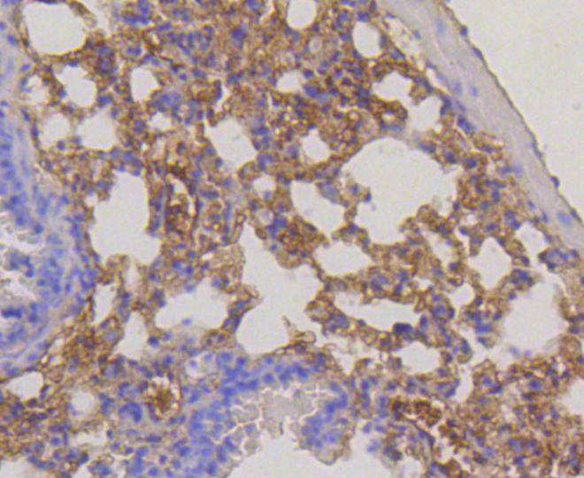 Anti-RPS3 Antibody (4S186)