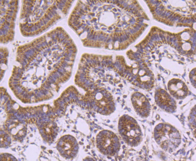 Anti-SDHA Antibody (3R603)
