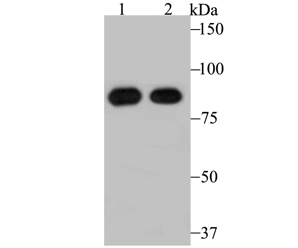 Anti-RRM1 Antibody (6Z102)