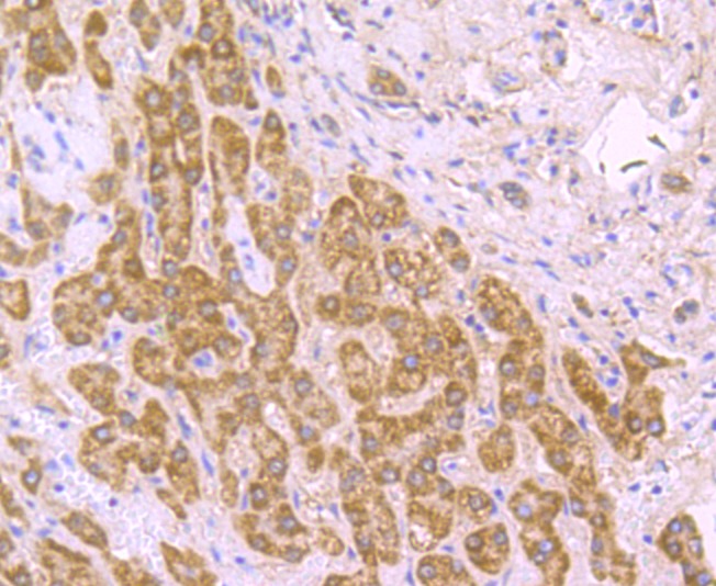 Anti-SDHB Antibody (3I144)