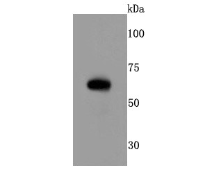 Anti-RPE65 Antibody (2D742)
