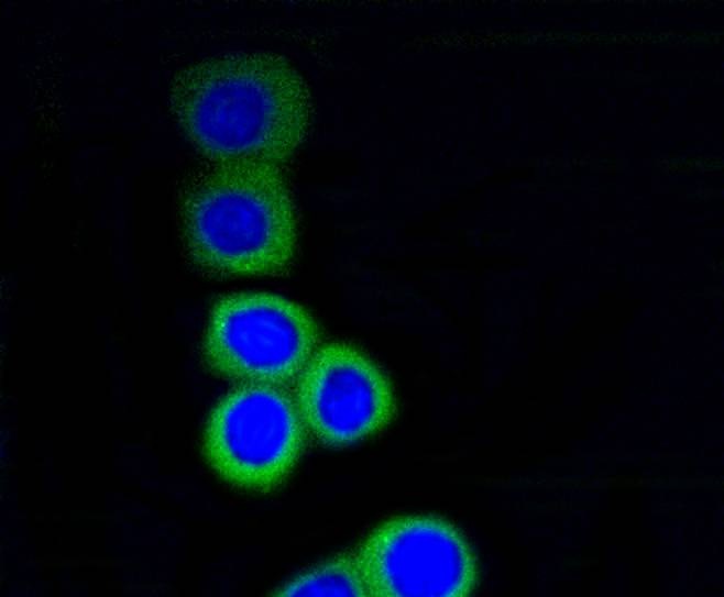 Anti-RPS3 Antibody (4S186)