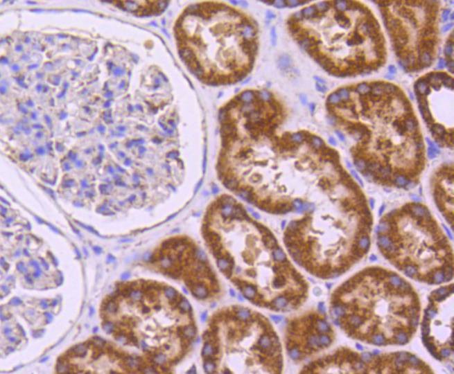 Anti-SGK1 Antibody (8M491)