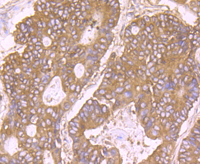 Anti-RPS19 Antibody (9D449)
