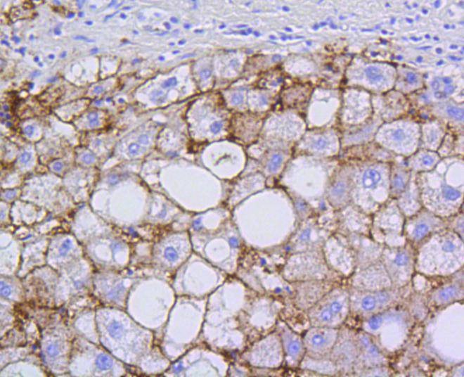 Anti-SR-BI/SCARB1 Antibody (1A957)