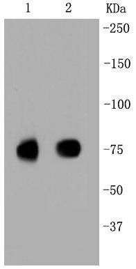 Anti-SR-BI/SCARB1 Antibody (1A957)