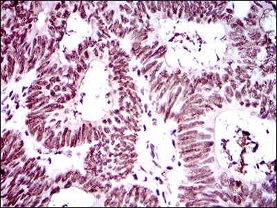 Anti-RING1 Antibody (1C89)
