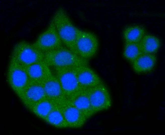 Anti-SR-BI/SCARB1 Antibody (1A957)