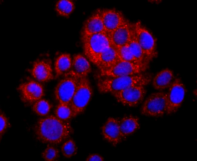 Anti-SDHA Antibody (3R603)