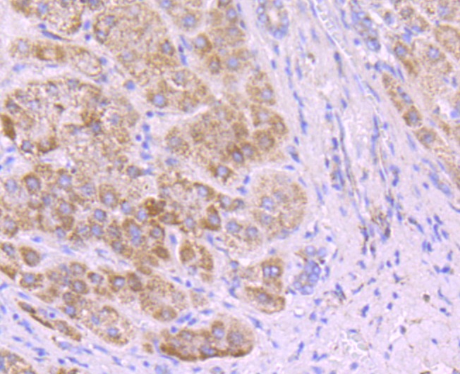 Anti-SDHA Antibody (3R603)