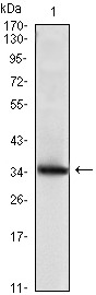 Anti-Mammaglobin-A/SCGB2A2 Antibody (6Q916)