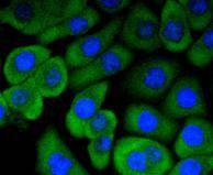 Anti-RON/CD136 Antibody (7D3)