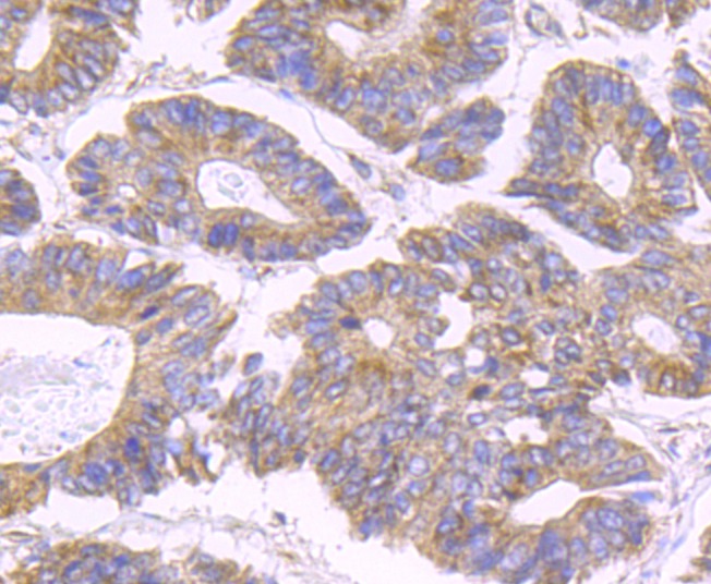 Anti-SDHB Antibody (3I144)