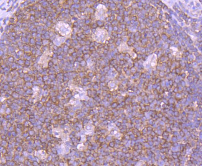 Anti-INPP5D Antibody (9H177)