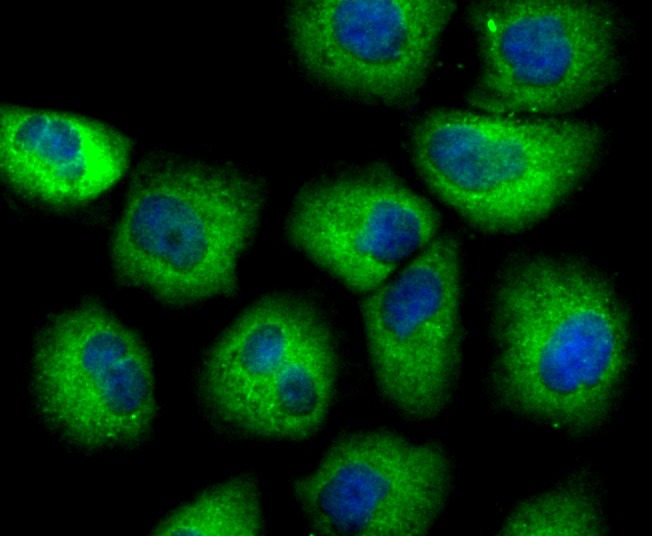 Anti-Uteroglobin Antibody (7Q840)