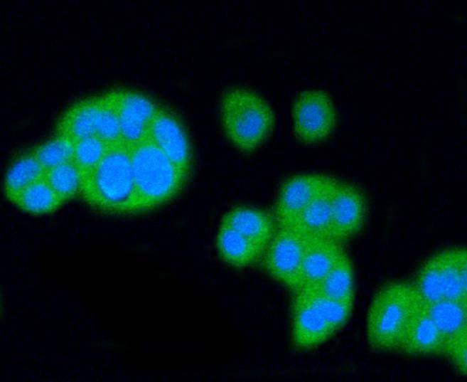 Anti-SR-BI/SCARB1 Antibody (1A957)