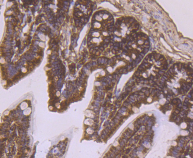 Anti-RPS19 Antibody (9D449)