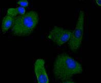 Anti-RON/CD136 Antibody (7D3)
