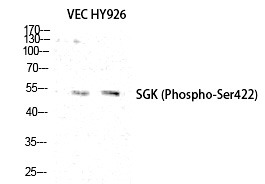 Anti-Phospho-SGK1 (Ser422) Polyclonal Antibody