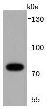 Anti-RIPK1 Antibody (1B304)
