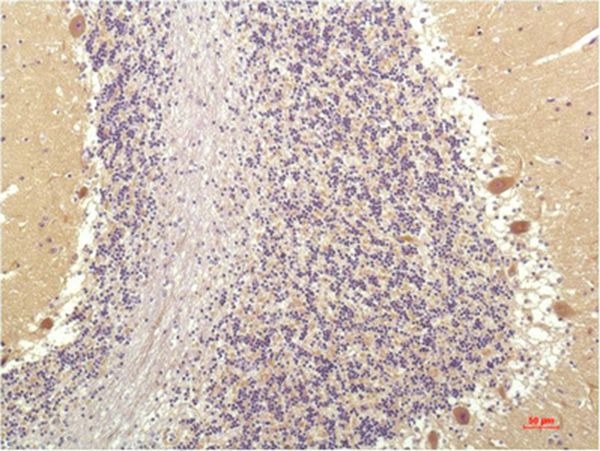 Anti-SGK1 Antibody (8Y942)