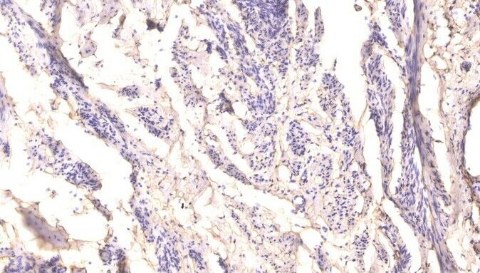Anti-Phospho-RIPK1 (Ser166) Polyclonal Antibody