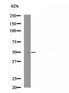 Anti-Phospho-Rpt6 (Ser120) Polyclonal Antibody