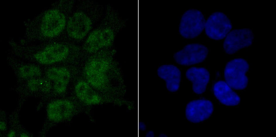 Anti-RPA1 Antibody (1L894)