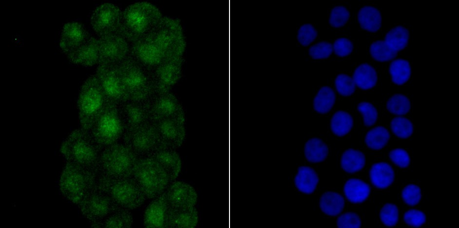Anti-RPA1 Antibody (1L894)